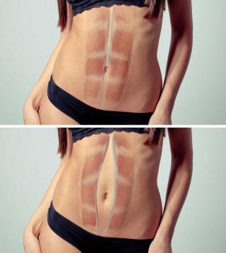 RETTI-ADDOMINALI-DIASTASI-320x359